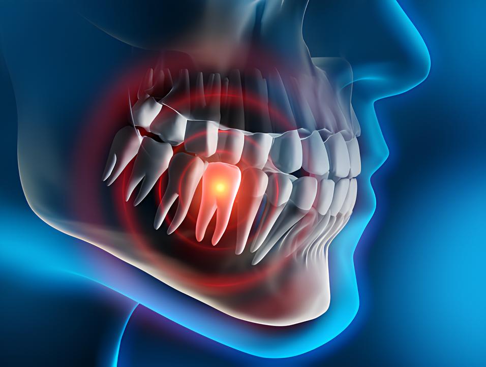 Teeth image - Emergency dentist Reigate